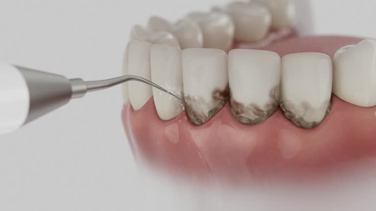 Trusted Teeth Cleaning And Checkup service in Riverdale, CA - Dentist Open Now